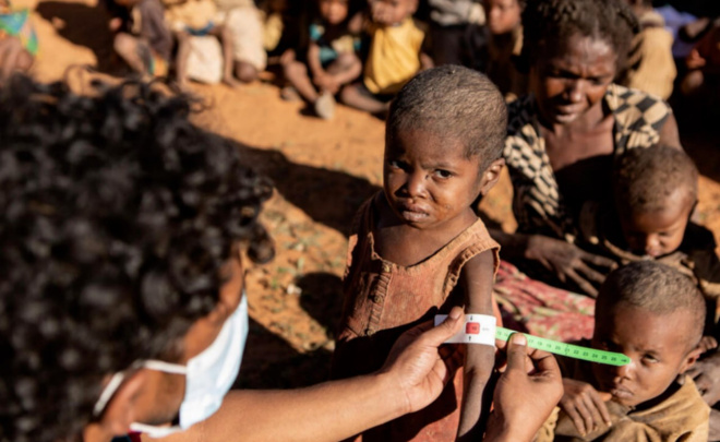 BMT: Afrikada har 6 soniyada ochlikdan bir bola vafot etmoqda
