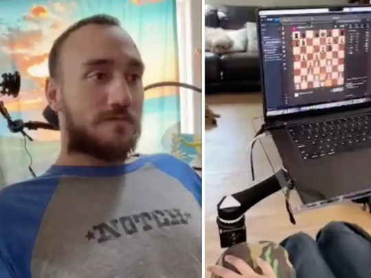 Neuralink chipi o‘rnatilgan erkak bir haftada fikr kuchi orqali videoo‘yin o‘ynashni o‘rganib oldi