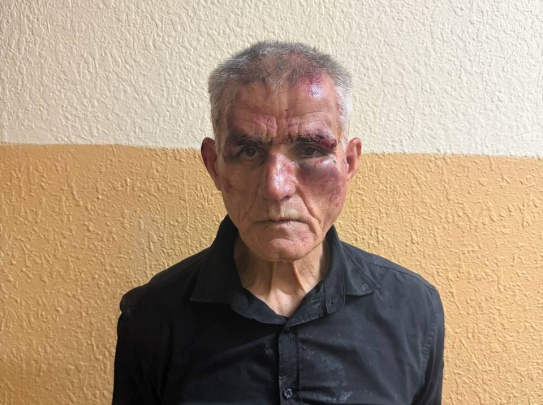 Toshkentda ruhiy kasal erkak ichki ishlar xodimini pichoqladi